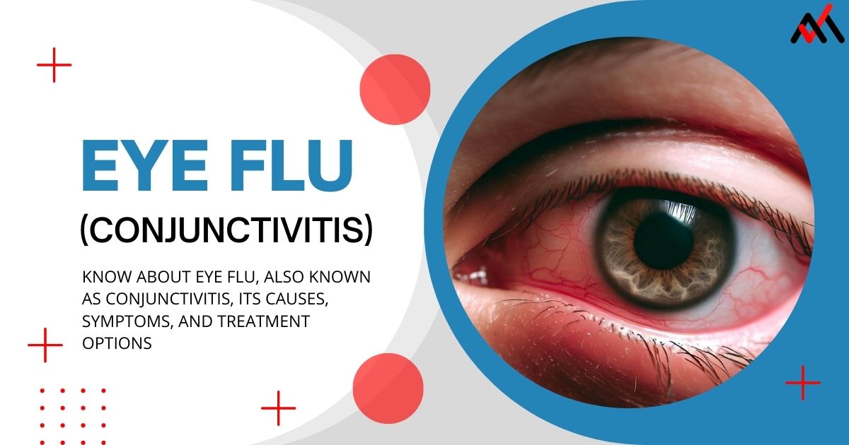 Eye inflamation, swelling, and redness in conjunctivitis or eye flu