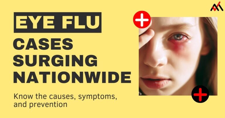 Symptoms of eye flu or conjunctivitis in a white girl with swollen eye, redness, and inflamation