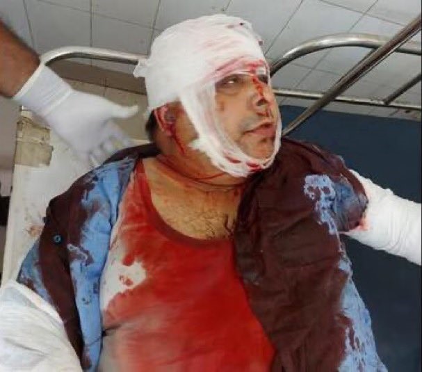 Sandeep Thapar in critical condition after assault